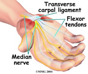 carpal-7-300x255.jpg