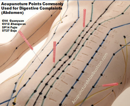 IBS-Acupuncture-Points-Abdomen.jpg